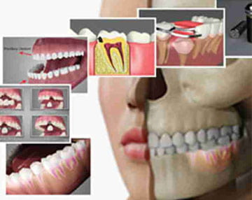 Dental PE Videos